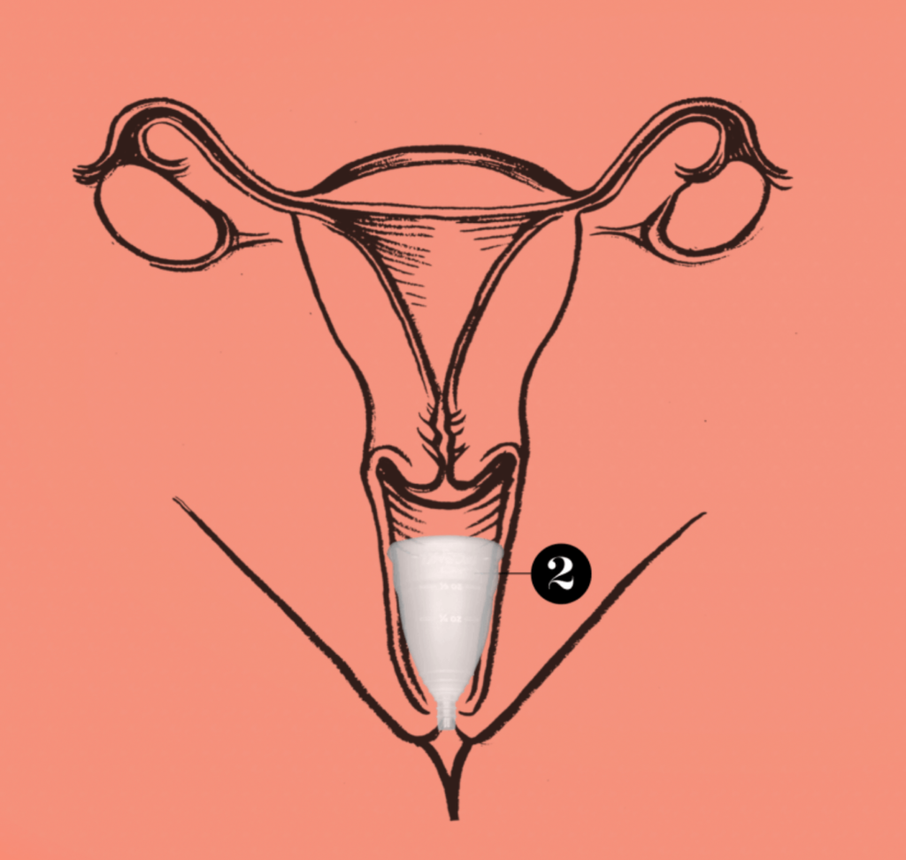 Diagram showing location of a Diva Cup inside vaginal canal