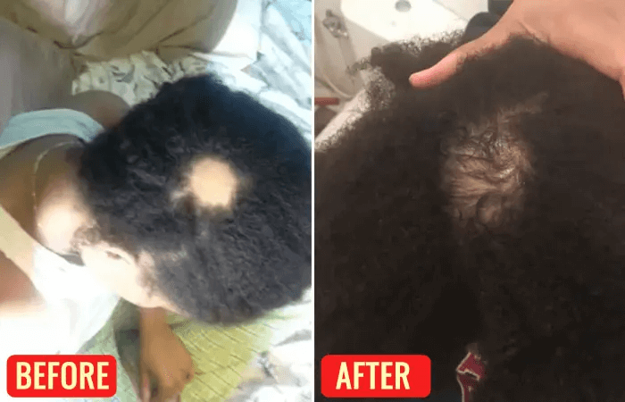 before and after of man's head using emu oil for hair growth