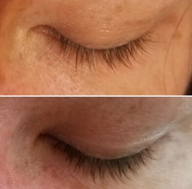 before and after of a woman's eyelash using Woolash