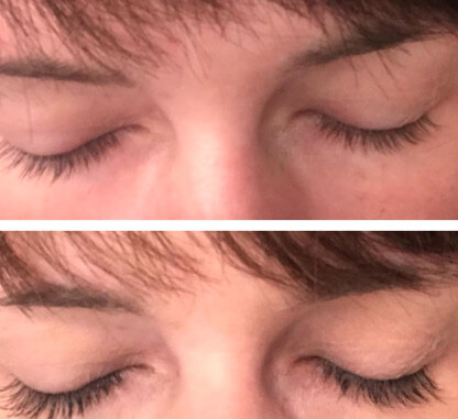 before and after of a woman's eyelashes using Woolash