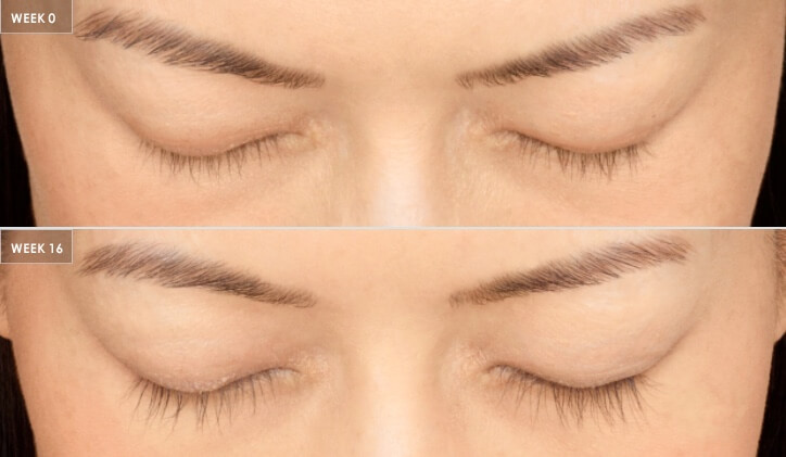 latisse growth serum before and after of woman's eyelashes and eyebrows