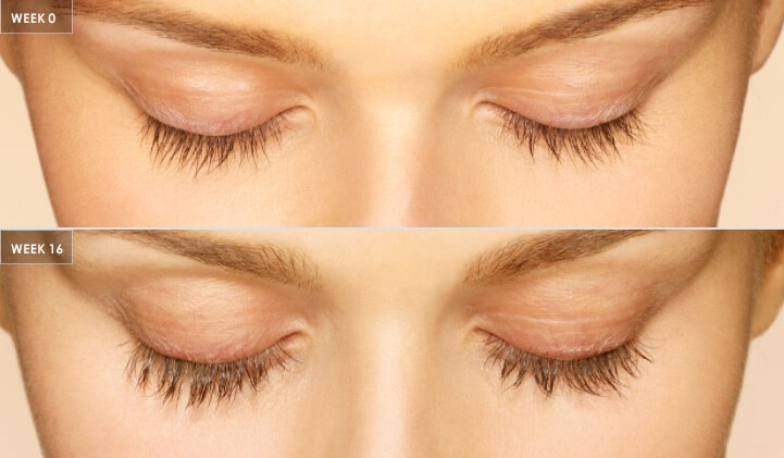 latisse growth serum before and after of a young woman's eyelashes and eyebrows