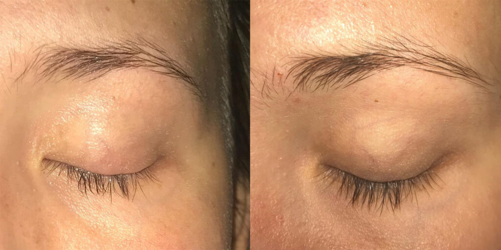 before and after of a woman's eyelashes