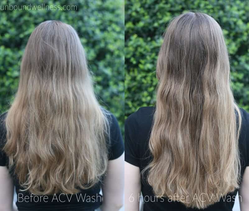 before and after photos of using apple cider vinegar