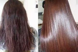 before and after photos of using apple cider vinegar