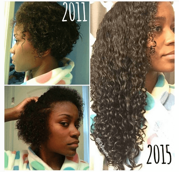 biotin hair before and after